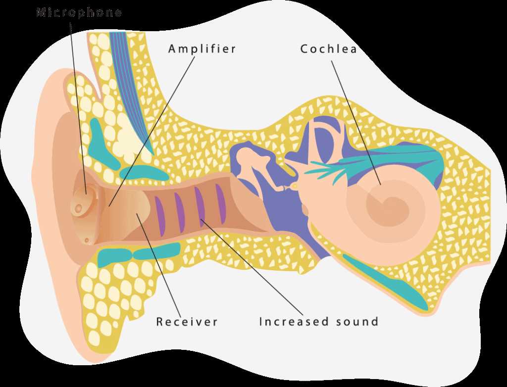 hearing aid parts diagram